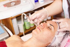 dermabrasion treatment