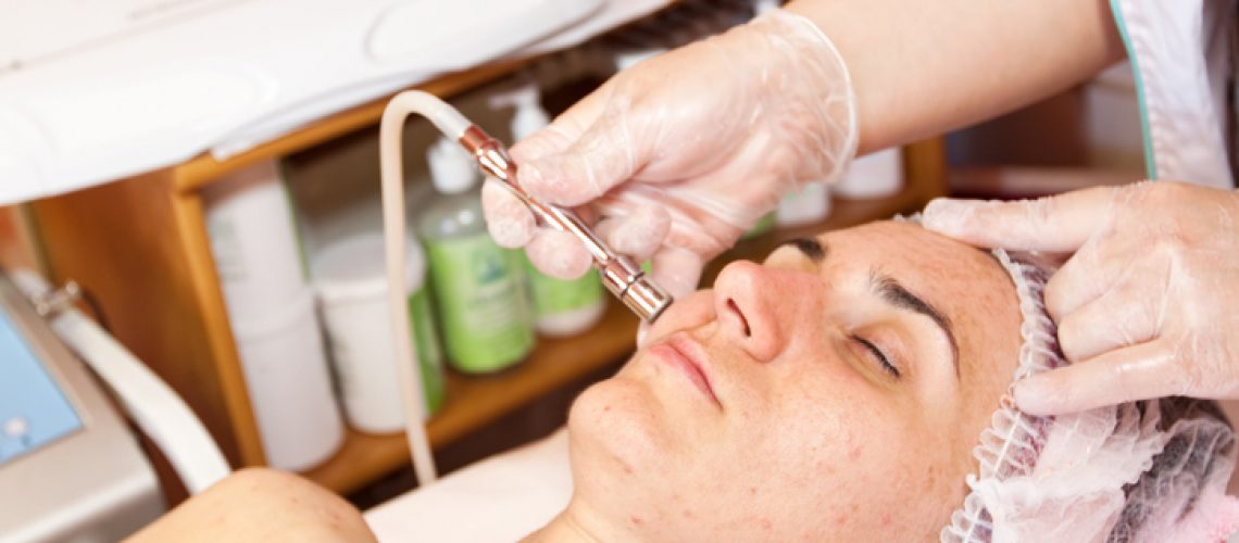 dermabrasion treatment